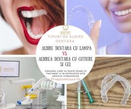 Albire dentara cu cape (gutiere dentare) Chisinau