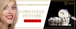 Coroane Dentare – echilibru perfect intre Timp, Calitate și Pret /DAVINCI dental clinic